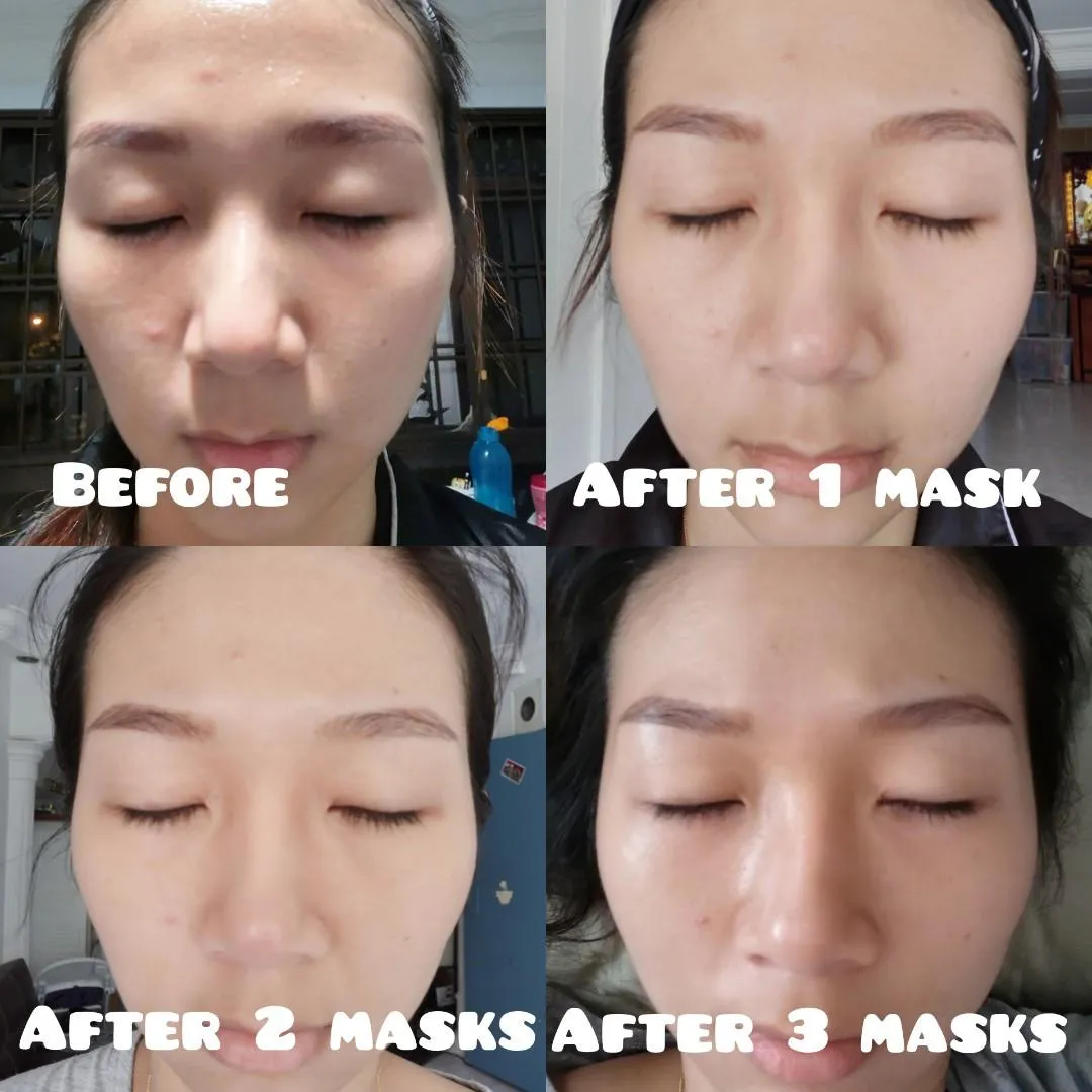 Rejuran Healer Healing Masks Damaged Skincare Treatments Wrinkles Soothing